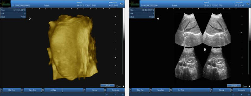 Laptop Full-Digital Ultrasound Scanner with 10.4