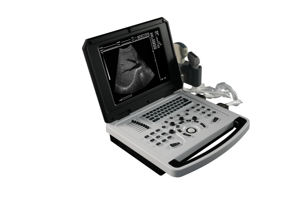 Notebook Black &white Ultrasound Scanner