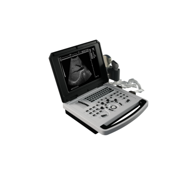 Ноутбук черно -белый ультразвуковой сканер