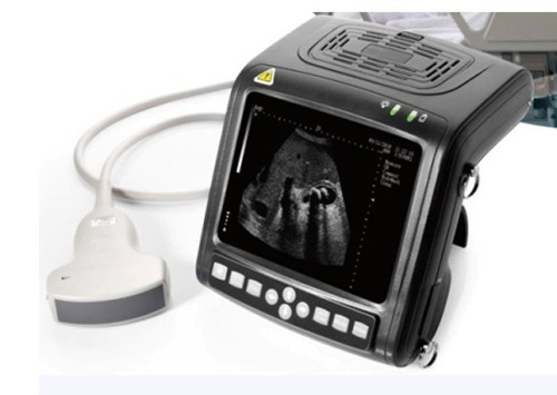 Portable Color Ultrasound Scanner