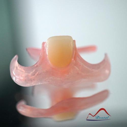 Valplast Denture On 3D Printing Model