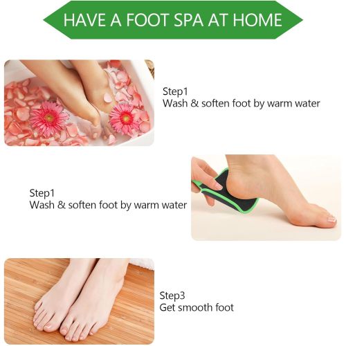 2 Pcs Curved Foot File Callus Remover