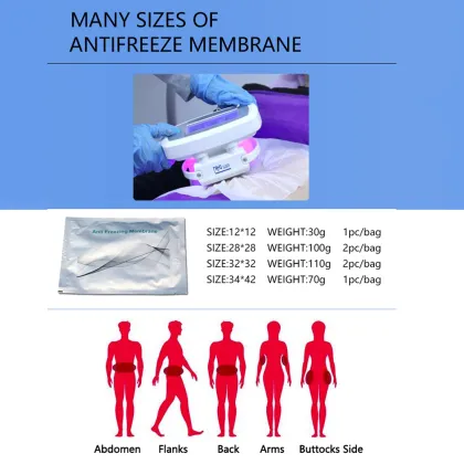 portable cryolipolysis slimming machine