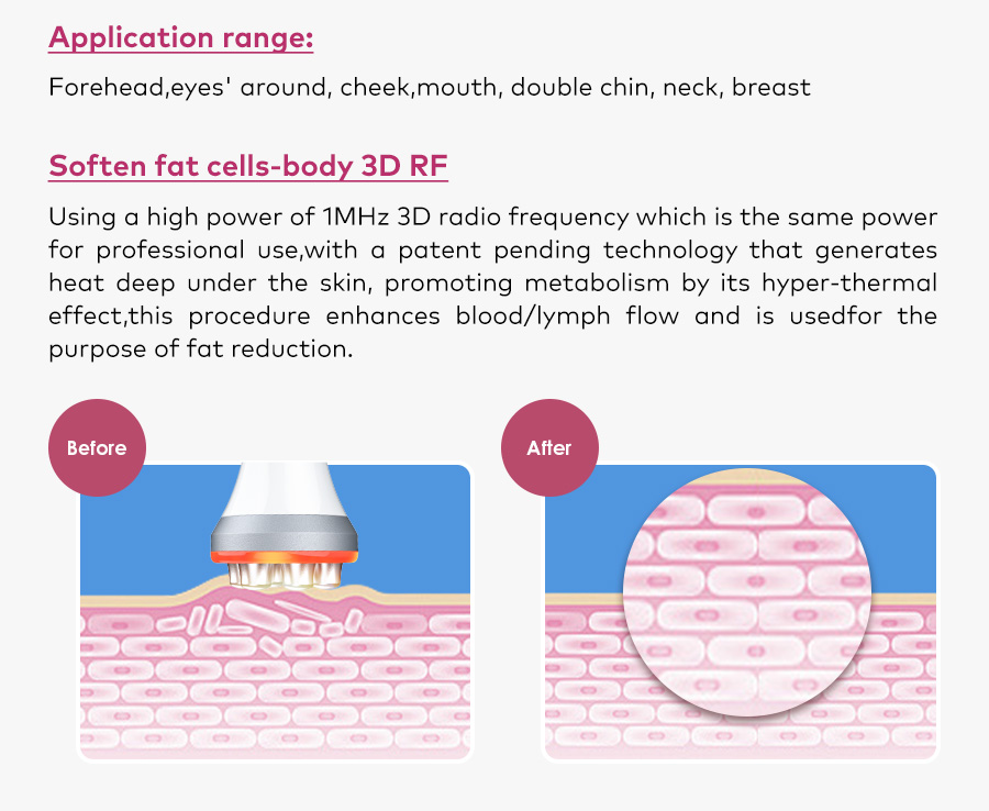 Omeina radio frequency skin tightening