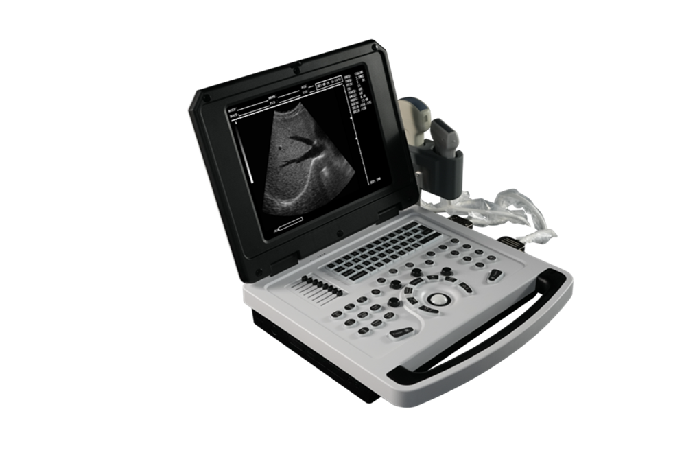 Notebook B-Ultrasound Scanner for Cardiovascular