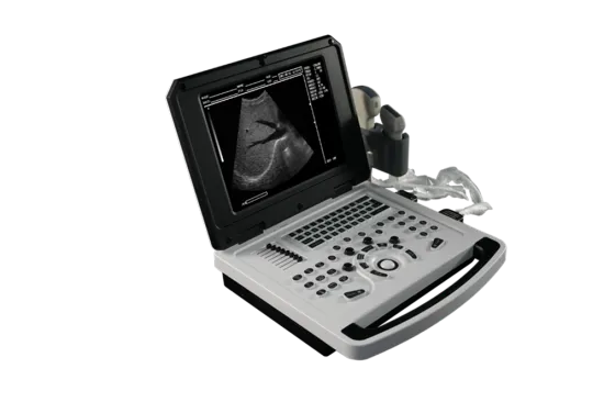 Notebook B-Ultrasound Scanner for Cardiovascular