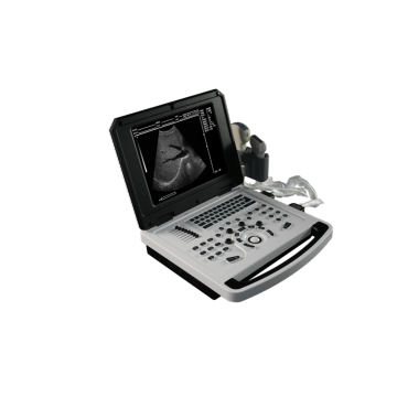 Notebook B-Ultrasound Scanner for Cardiovascular