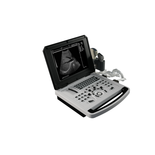 Cahier B-ultrasound Scanner pour cardiovasculaire