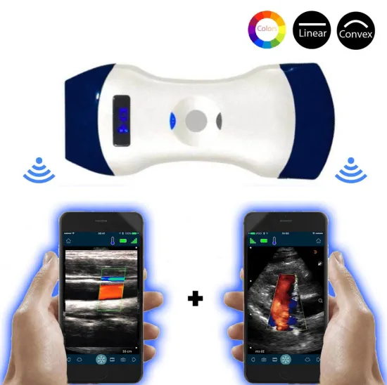 OEM Wifi Convex & Linear Color Ultrasound Probe