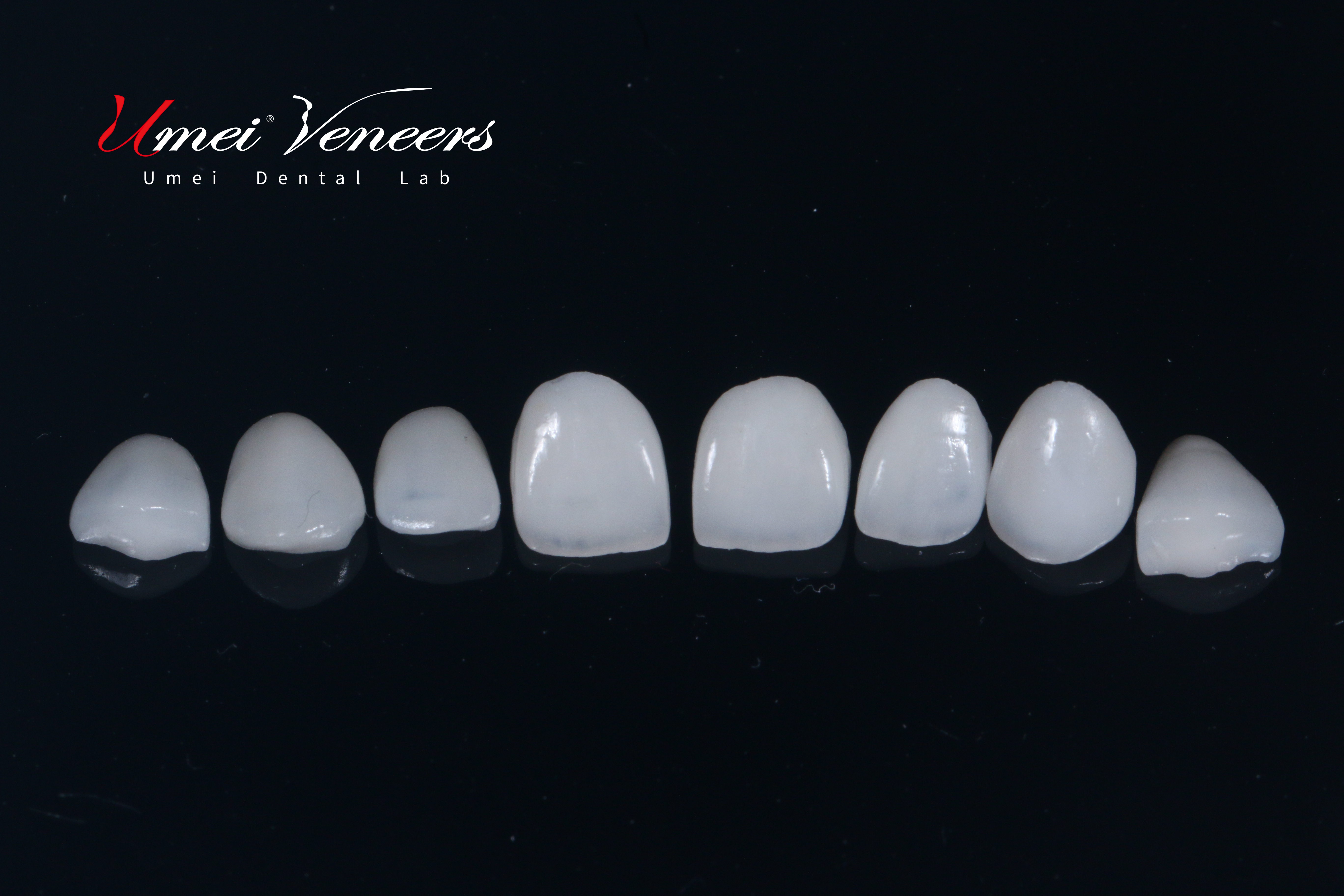 veneer