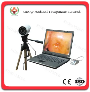 SY-F003 Guangzhou Medical Colposcope For Sale Portable Electronic Colposcope