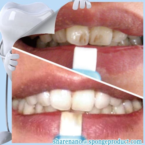 Teeth whitening and scaling removal oral hygiene