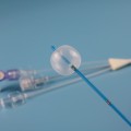Disposable Stone Extraction Balloon