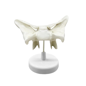 Sphenoid Bone Enlargement ZM1015-1 24.5*10*16