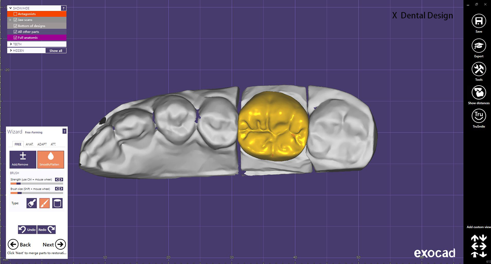 Serbisyo ng Dental Dental Design