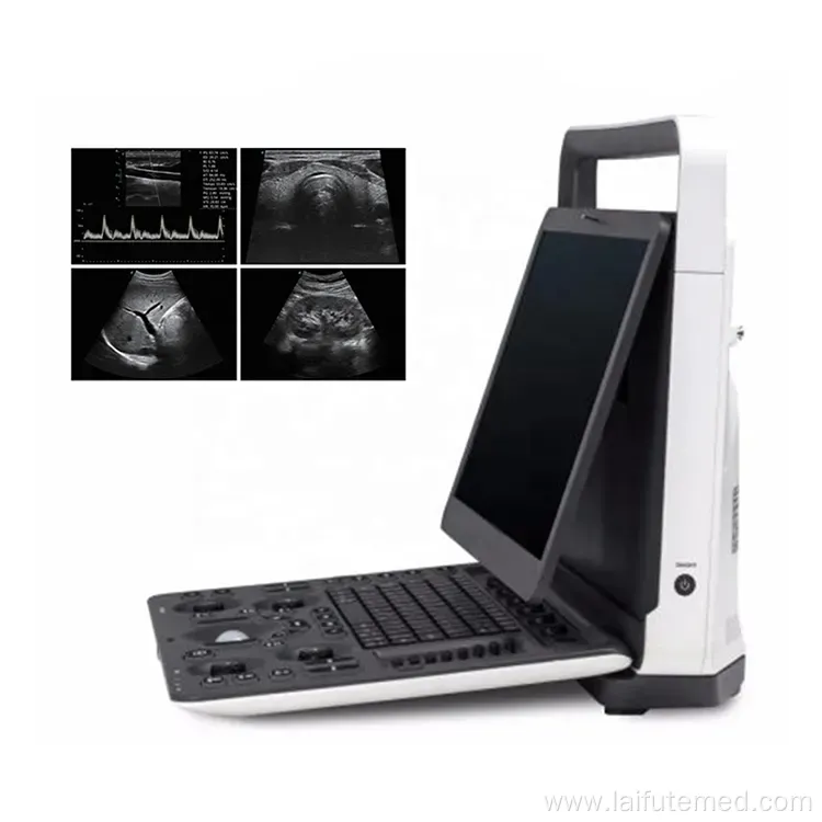 Sonoscape E1 Portable Animal Ultrasound