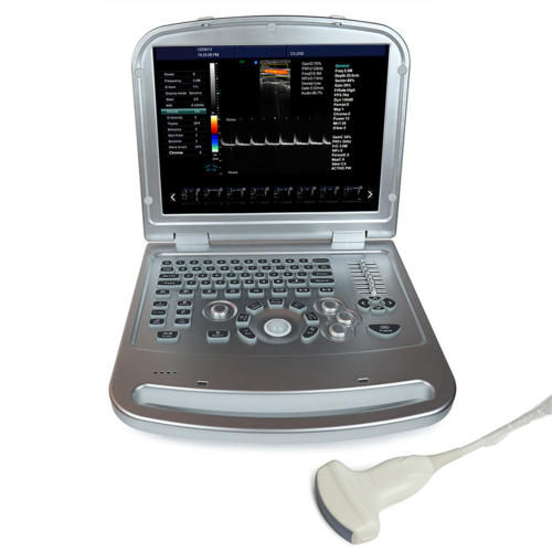 Color Doppler Ultrasound Machine for Cardiac