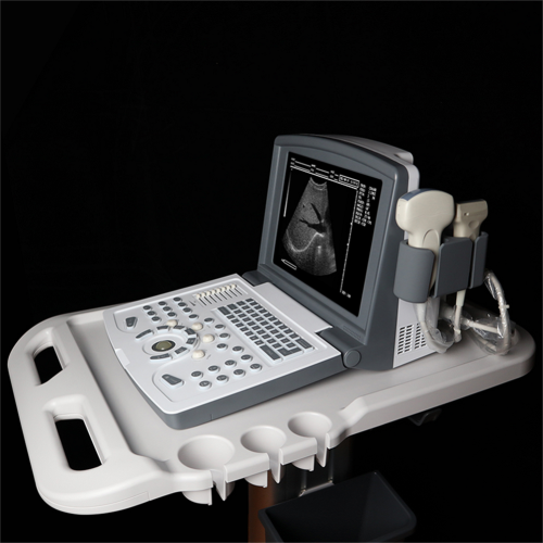 Portable Ultrasound Scanner Portable Black And White Ultrasound Scanner for Urology Manufactory