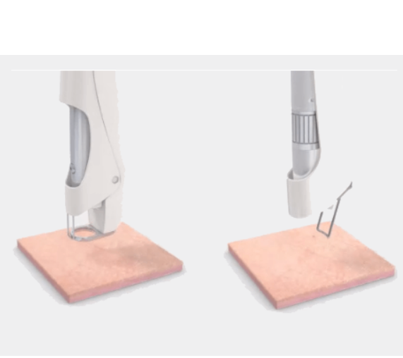 Choicy picosecond เลเซอร์ ttreatment handpiece