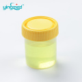 Tách nước tiểu trong suốt