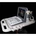 Portable Color Doppler Ultrasound Machine for Abdomen