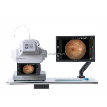 Harga kamera retina ophthalmic China reticam-3100