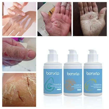 Custom Logo Skin Care: Whitening, Moisturizing Hand Cream, Face Cream & Body Lotion