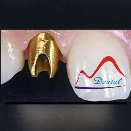 Co-Cr Alloy Customized Implant Abutment