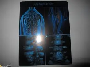 X-ray Sex Image Cr System Veterinary Cr X-ray System, High Quality X