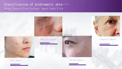 Factory Price Skin Analyzer