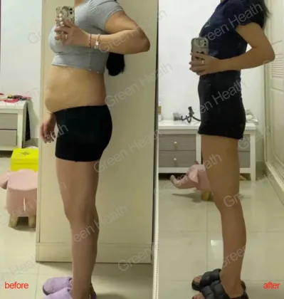 Block Calorie Absorption White Kidney Bean Slim Jelly