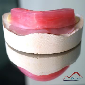Implant Wax Rim Try In
