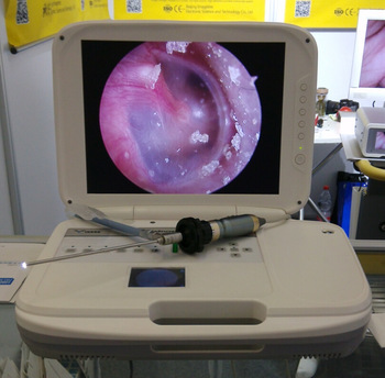 Video otoscopes camera endoscopy