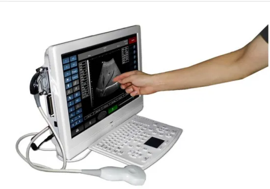 ultrasound equipment Touch Screen