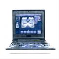 Peralatan ultrasound komputer riba untuk penyakit perut greyhound