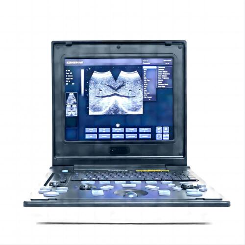 Εξοπλισμός υπερήχων φορητού υπολογιστή για ηπατική νόσο Poodle
