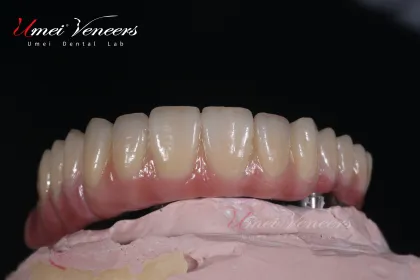 Sturdy zirconium oxide bridge frame