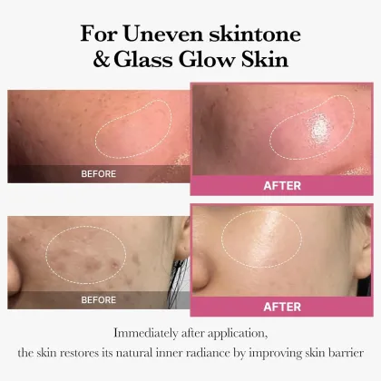 Korean Skin Care: Elastic Moisturizing Repair Serum & Mask