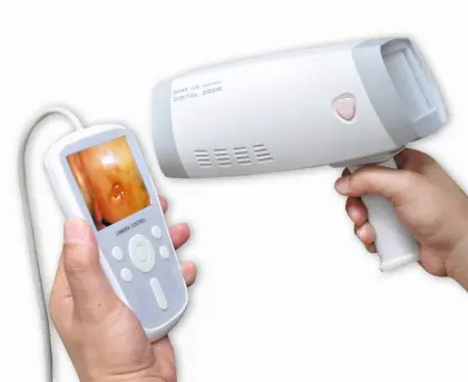 Handheld Direct-to-Screen Video Colposcopy
