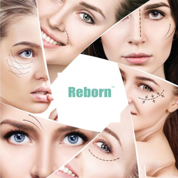 Marionette lines removal dermal filler