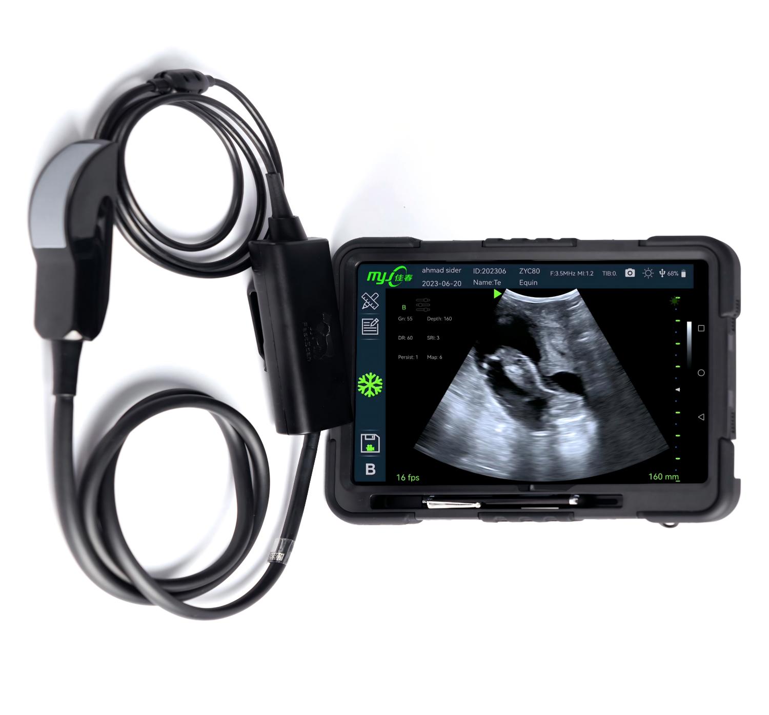portable cattle ultrasound machine