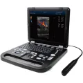 Portable 4D Ultrasound Machine for Veterinary Use