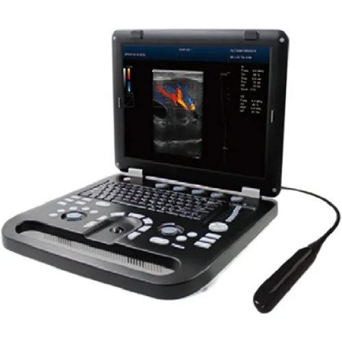 Portable 4D Ultrasound Machine for Veterinary Use