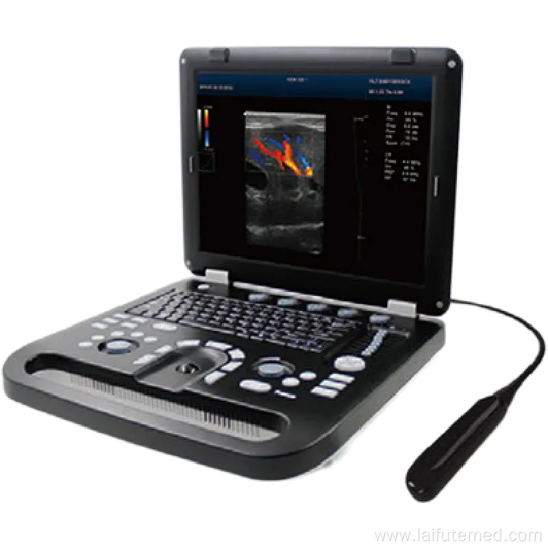 Portable 4D Ultrasound Machine for Veterinary Use