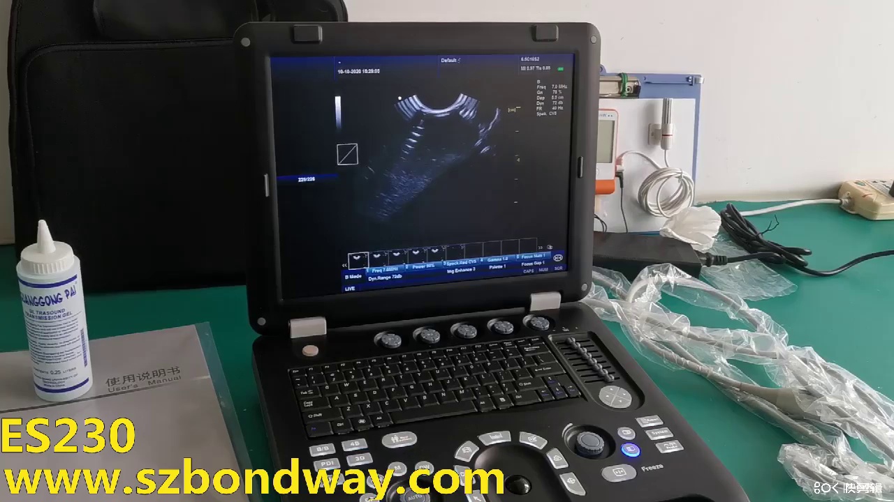 Es230V Veterinary Ultrasound Color Doppler System