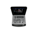 Scanner de ultrassom Doppler colorido para notebook para ginecologia