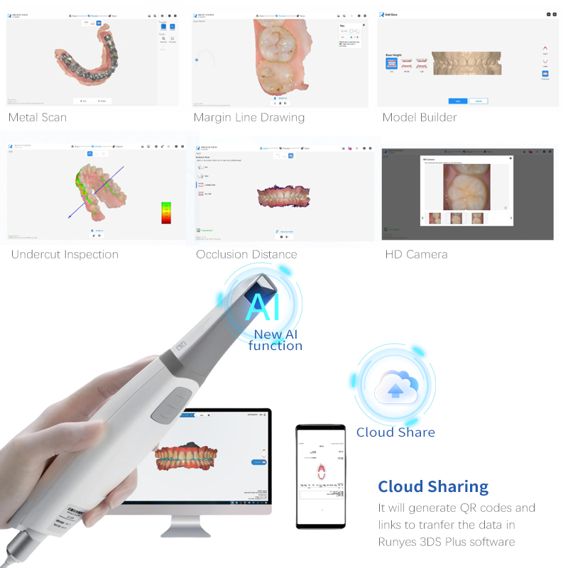 Dental Intraoral Scanner