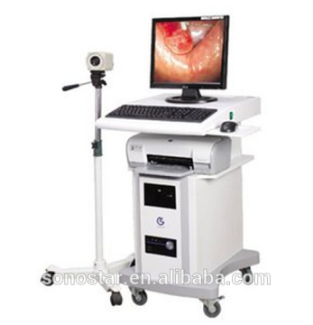 SVC-100 Colposcope(9)