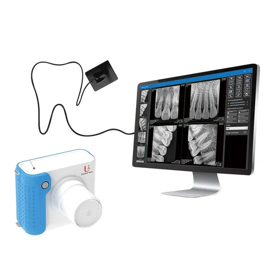 Portable Dental X-ray Unit and RVG Sensor for Clinic