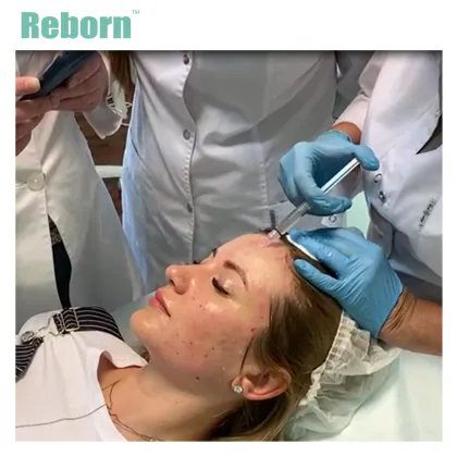 Medical Cosmetic Filler for Skin